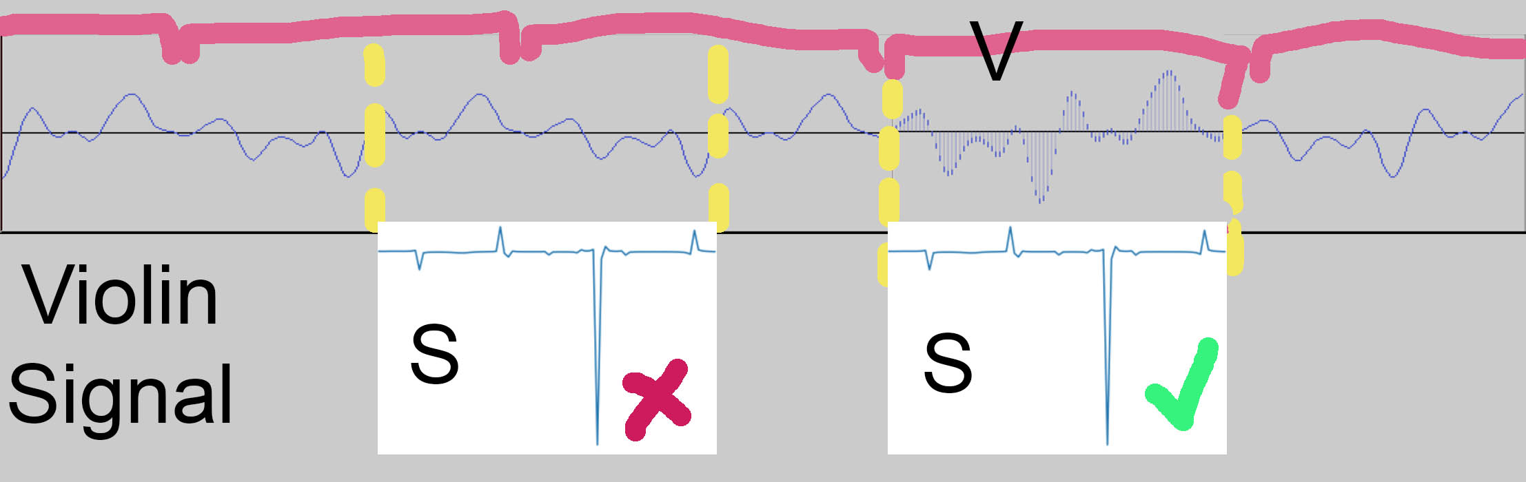 Visual representation of the misalignment problem